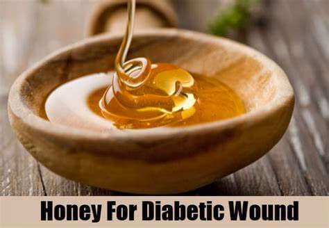 عسل برای درمان زخم