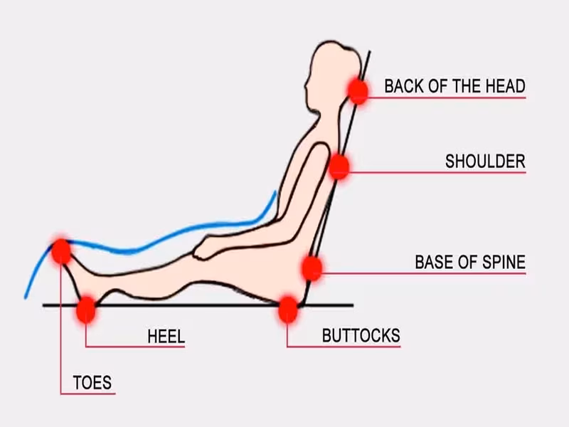 نواحی مستعد ایجاد زخم بستر