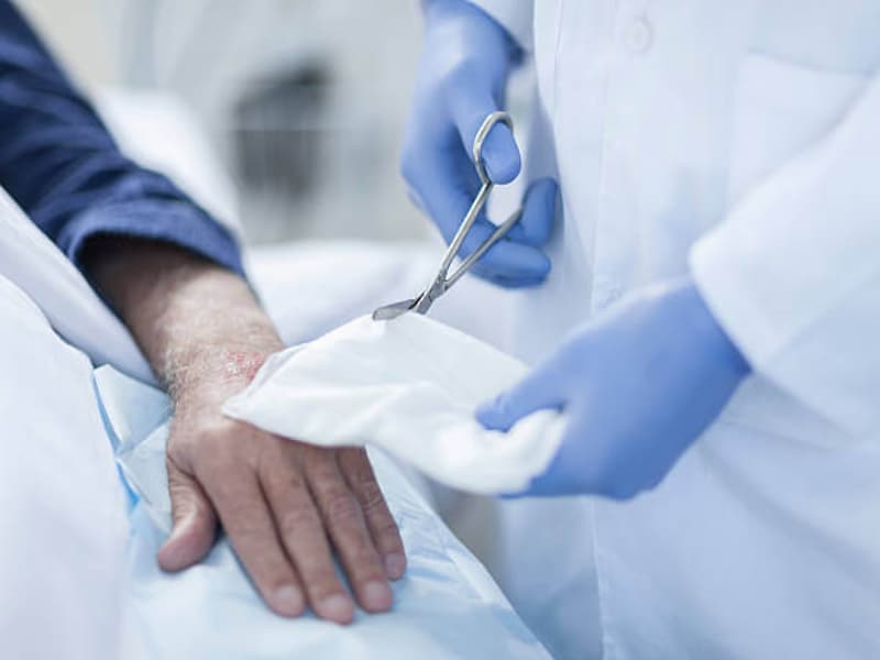 درمان زخم بستر در منزل