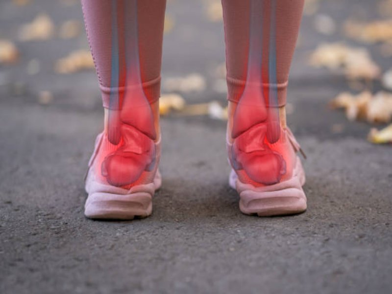 مهمترین اصول درمان زخم پای دیابتی