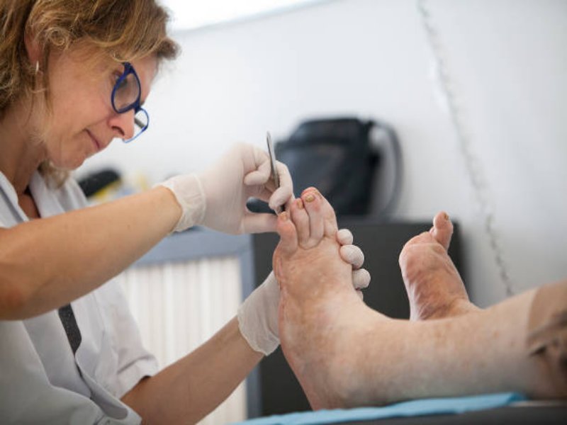 درمان تخصصی زخم دیابتی | شهرک غرب + سعادت آباد + اعزام 30 دقیقه ای کارشناس زخم