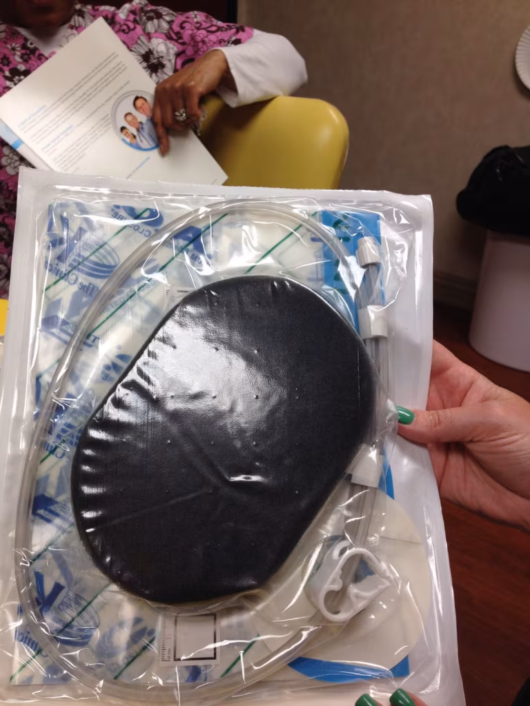 وکیوم تراپی برای درمان زخم بستر